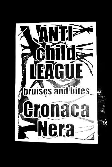 ANTICHILDLEAGUE / CRONACA NERA – Bruises and Bites CS